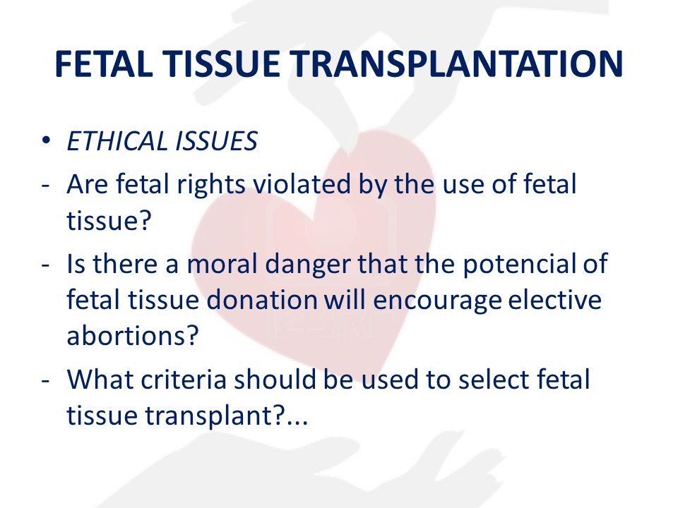 Ethics of fetal tissue transplantation.